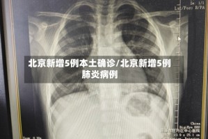 北京新增5例本土确诊/北京新增5例肺炎病例