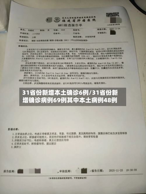 31省份新增本土确诊6例/31省份新增确诊病例69例其中本土病例48例-第3张图片
